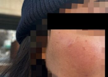 South Korean Authorities Arrest Suspect in Assault on International Student from Singapore