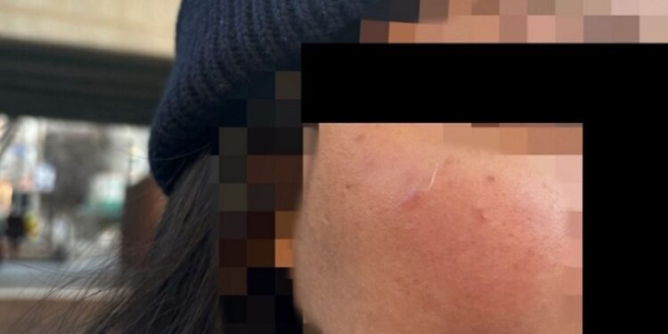 South Korean Authorities Arrest Suspect in Assault on International Student from Singapore