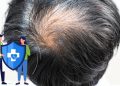 A Question of Coverage: Lee’s Hair-Loss Proposal and the Limits of Public Insurance