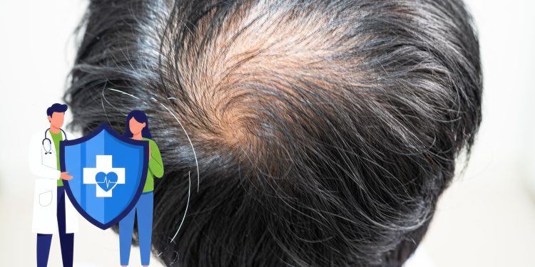 A Question of Coverage: Lee’s Hair-Loss Proposal and the Limits of Public Insurance
