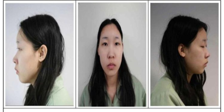 South Korea Laced Drink Case Points to Wider Pattern as Victim Count Rises